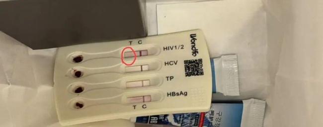 酒店洗漱包現(xiàn)已用HIV檢測盒