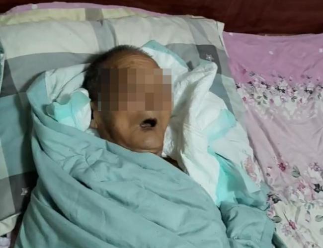 老人被毒蛇咬傷后病情惡化放棄治療 家屬艱難抉擇
