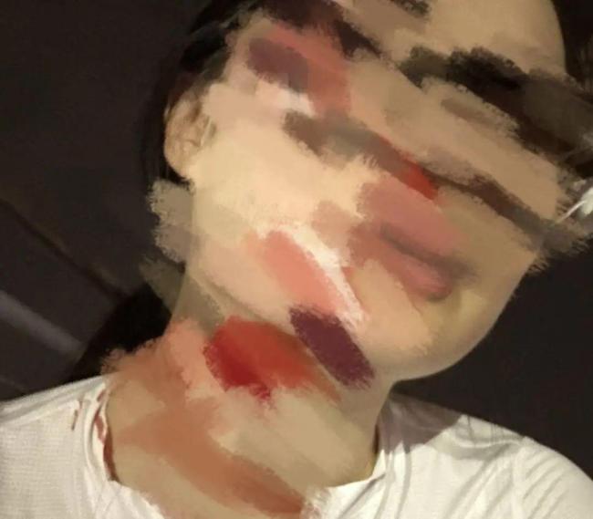 女子骑行时被鱼线绊倒受伤 安全隐患引关注
