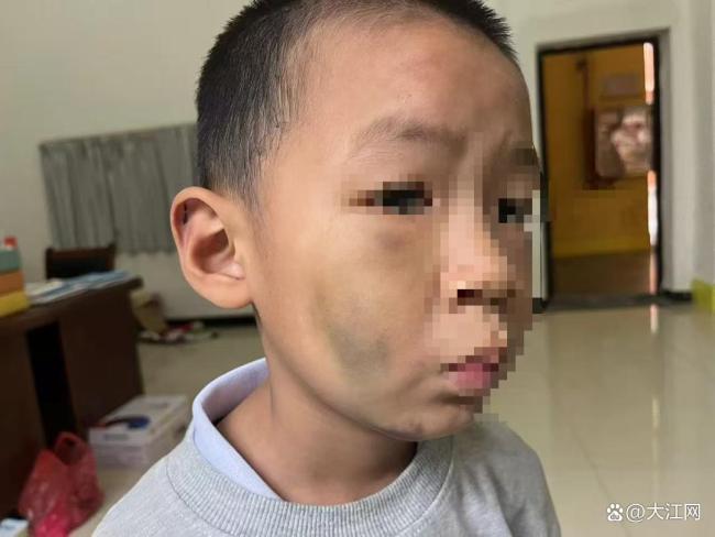 7歲男童遭長(zhǎng)期毆打生父被拘 繼母亦涉虐待