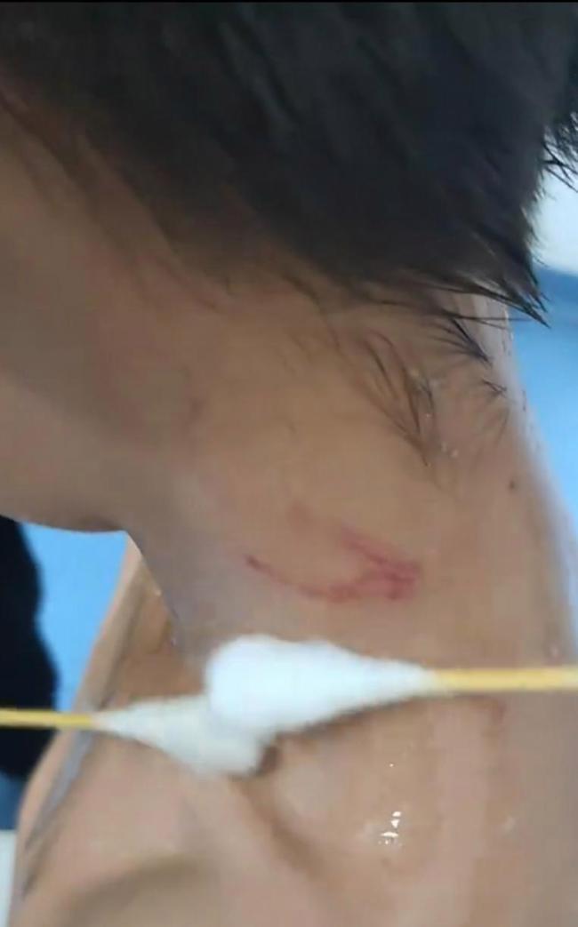 七歲男孩對猴子豎中指 被五猴騎頭“暴揍”