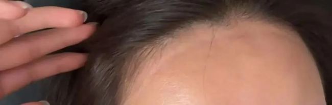 防曬面罩越戴越黑 真相揭秘