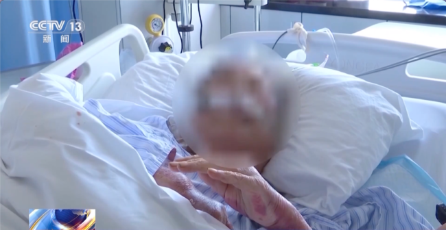 死亡率高！高溫“桑拿天”,，這種病正高發(fā)