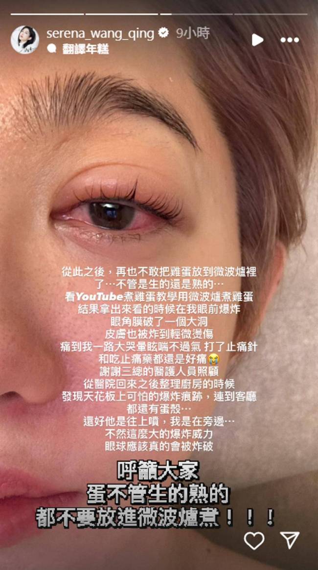 女演員微波爐煮蛋被炸傷眼睛 安全隱患需警惕