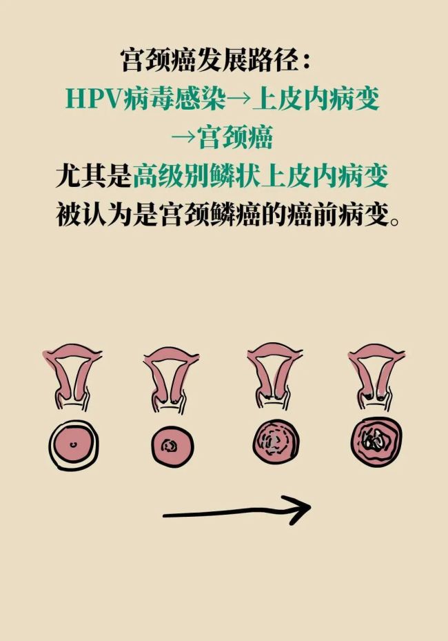 年年体检却患癌？因为你忽视了“最后的警告”，7类癌前病变全解析