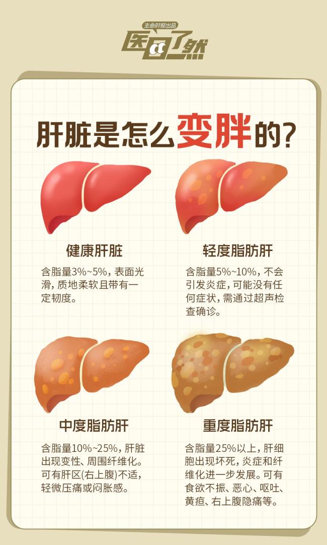 脂肪肝超过这个程度就危险了 警惕6大征兆