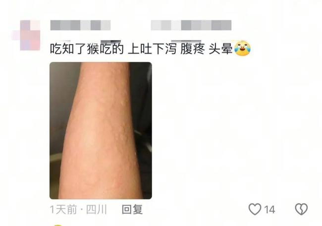 男子吃蝉蛹过敏眼睛肿成“奥特曼” 异性蛋白引发超敏反应