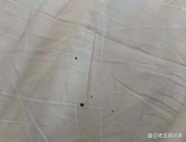 男子住全季酒店掀被发现数根卷毛 床单卫生问题引关注