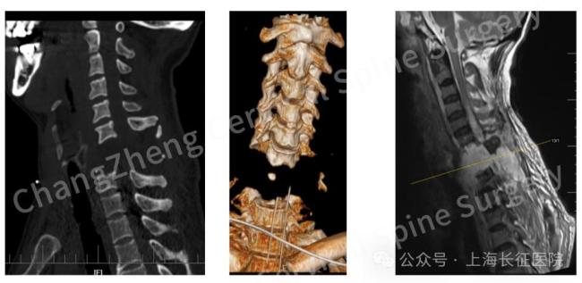 外科医生回答说患者被从身体和头部救出，手术