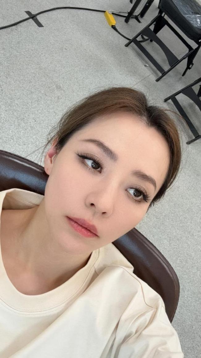 张靓颖自曝患病 伸懒腰手掌流血十年