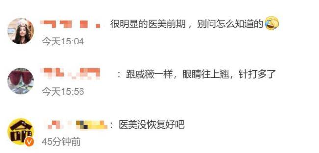 吴昕晒近况被质疑医美过度 脸部状态引争议