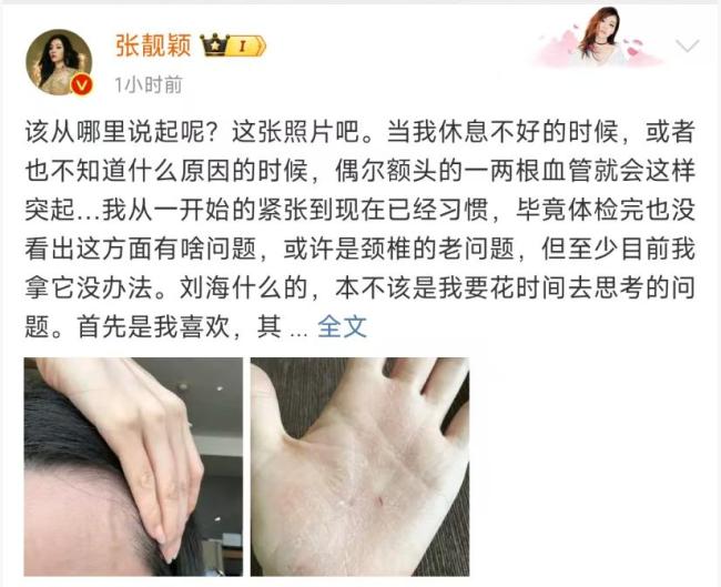 张靓颖发文谈自己的健康状况
