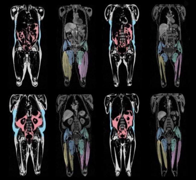 科学家眼中的“长寿身材”什么样 腰细臀粗腿粗更健康