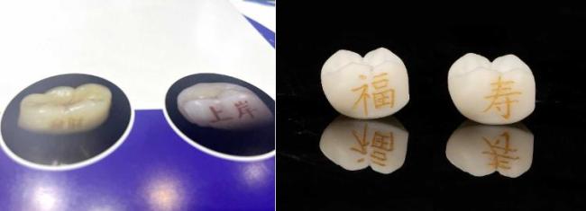 牙齿文身风靡齿科：牙冠刻印“发财”