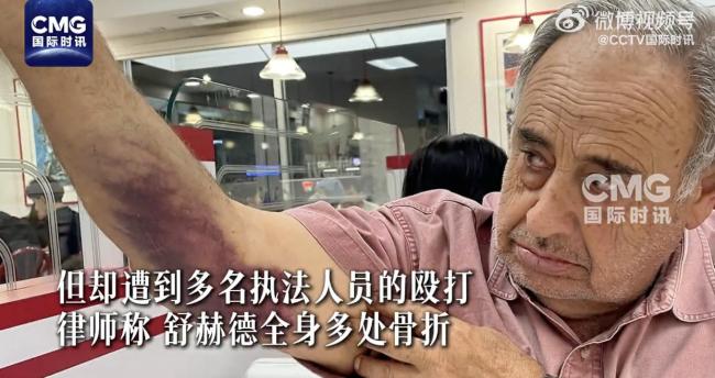 曝美国多地执法人员过度使用暴力 移民执法争议不断