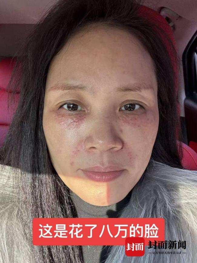 女子轻信能年轻10岁 整形失败维权难 遭遇“拼房整形骗局”
