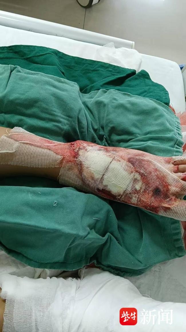 盐城两姐妹车祸1轻伤1重伤 母亲自责不已