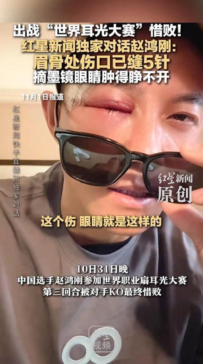 “耳光比赛”赵鸿刚谈失利:没训戒 勇气与极限的反想