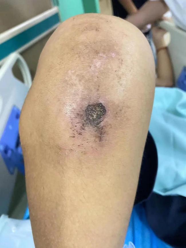 男孩被虐28天致重伤二级 成长基地背后的残酷真相