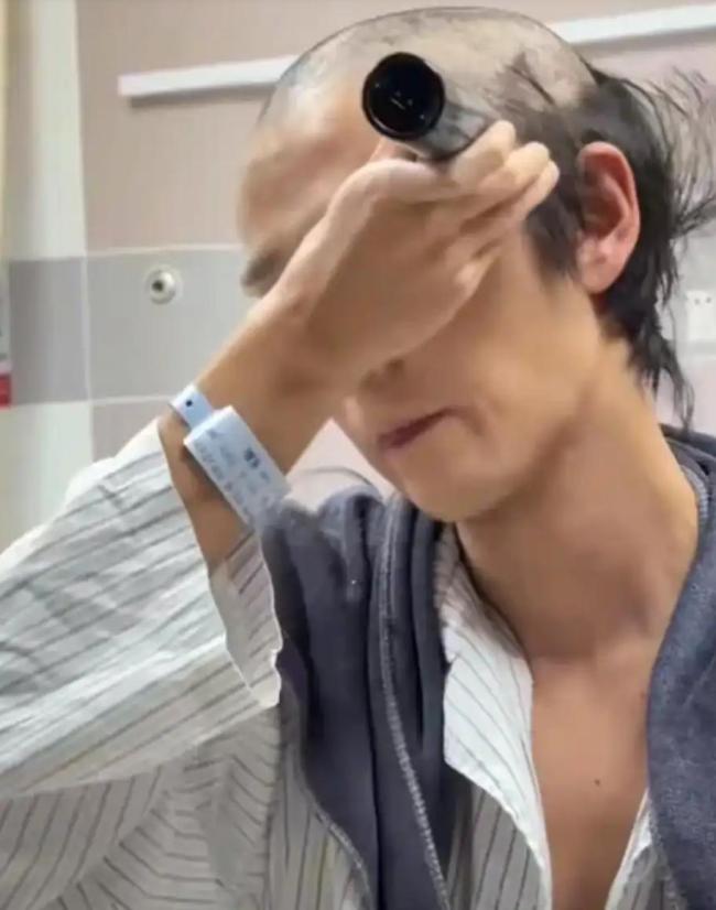 郭聪明自曝患特发性震颤数年 与病痛抗争的坚韧歌手