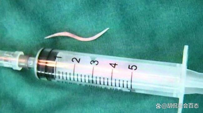 男子中午吃一条鱼 下午上班死亡 小鱼刺引发大悲剧