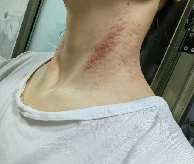 女护士五年的“漫长死亡” 无处可逃的家暴深渊