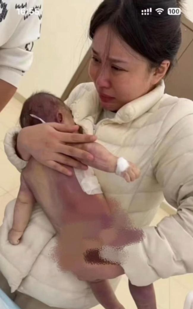 女婴心脏手术去世外婆担心女儿