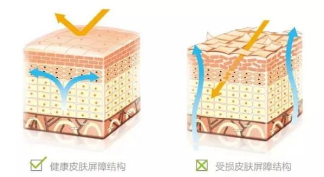 硫磺皂是皮肤神器还是毁肤“杀手” 科学使用方显真效