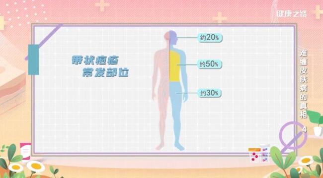 拆完快递没洗手，当心“惹”上眼部带状疱疹