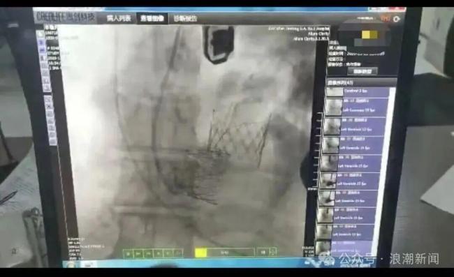 醫(yī)院3萬瓣膜賣出28萬 患者家屬發(fā)聲 高額醫(yī)療費(fèi)引爭議