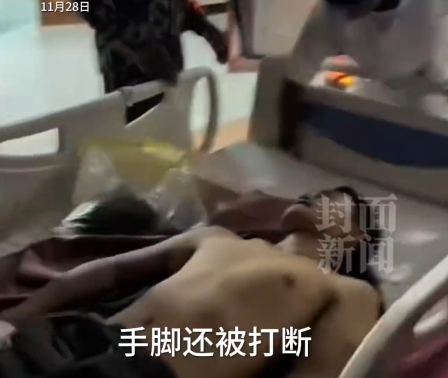 27岁网红在非洲遭绑架 跳车逃生 手脚被打断引发关注