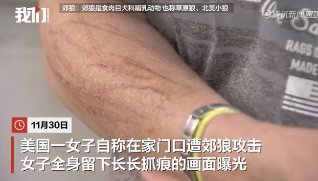 美国一女子自称在家门口遭郊狼袭击 罕见事件引发关注