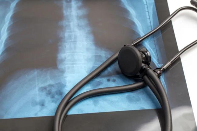 40歲后這兩項體檢不要跳過 關注肺與骨健康