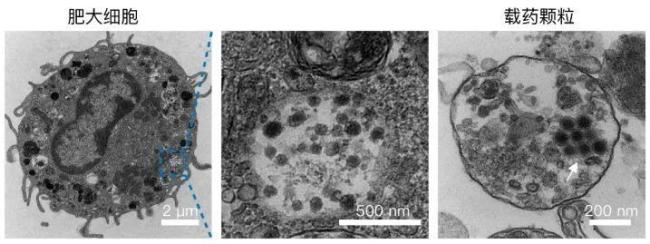 中国科学家发现抗癌新利器 过敏反应转为抗癌武器