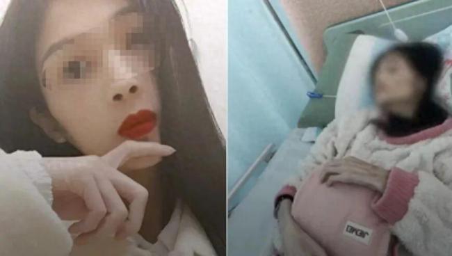 志愿者讲述胃萎缩女孩暴瘦至35斤 不幸离世引发关注