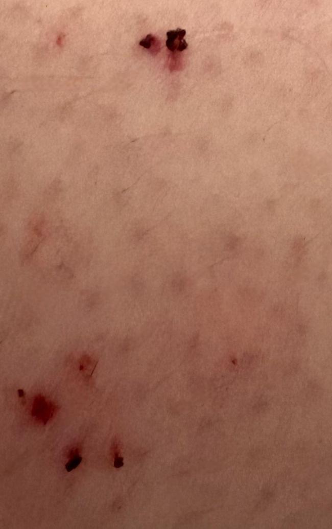 澳洲女子丛林寻宝 毒蛇钻入球鞋卡住 冷静应对获救