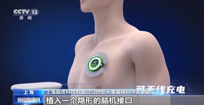 当脑机接口走入生活 会为我们带来哪些新可能？