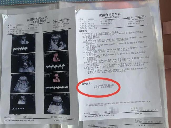 女子怀孕每次产检发现多出一胎：两个月内从一胎变四胞胎 罕见同卵四胞胎引发关注