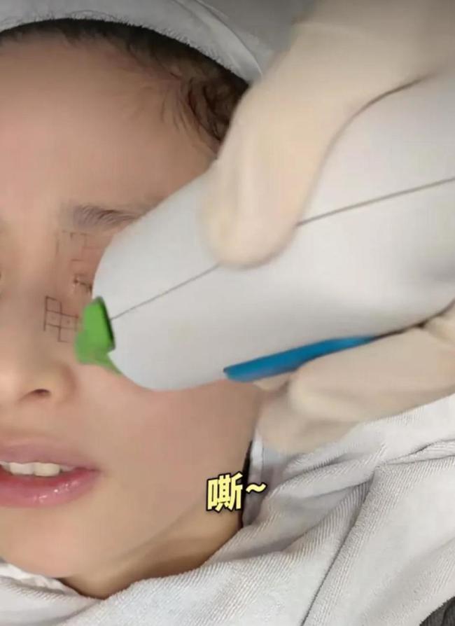 颖儿做眼部热玛吉疼哭了 明星的美丽代价