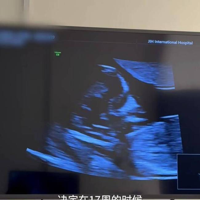 程晓玥自曝二胎孕期食量惊东谈主 周折后的幸福期待