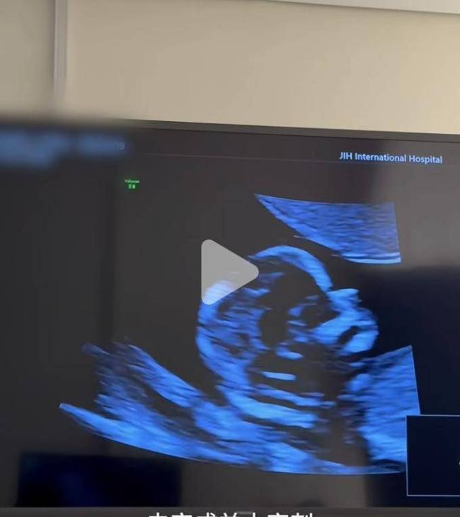 程晓玥自曝二胎孕期食量惊东谈主 周折后的幸福期待