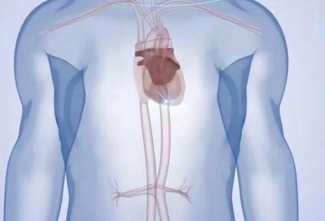 中国科学家新发明:心脏成“充电宝” 心跳供能创新突破