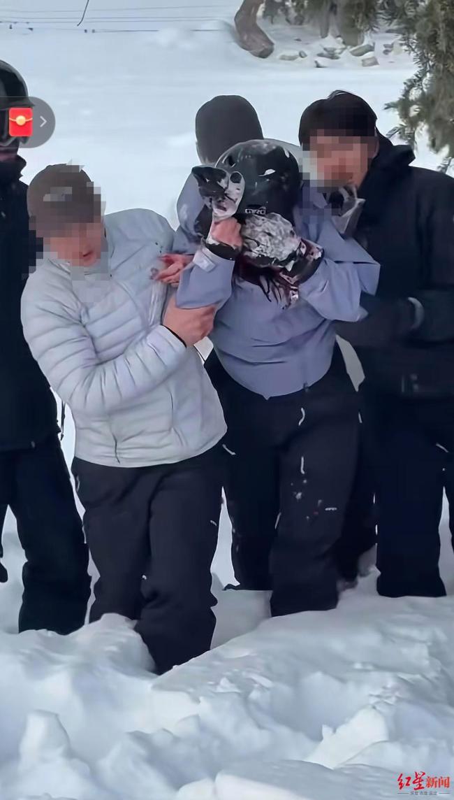 雪豹伤人事件当事人：没有摸雪豹，目击者还原真相