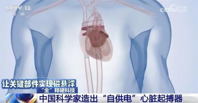 科学家造出“自供电”心脏起搏器 心跳供电奥秘揭晓