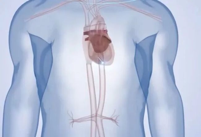 心脏能成为“充电宝”?我国科学家有新发明