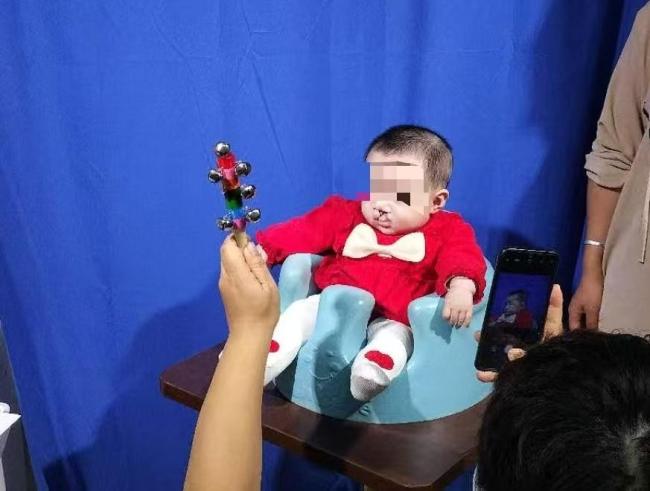 李亚鹏拼命要救的唇腭裂患者们：我很渴望和人说话 免费治疗带来希望