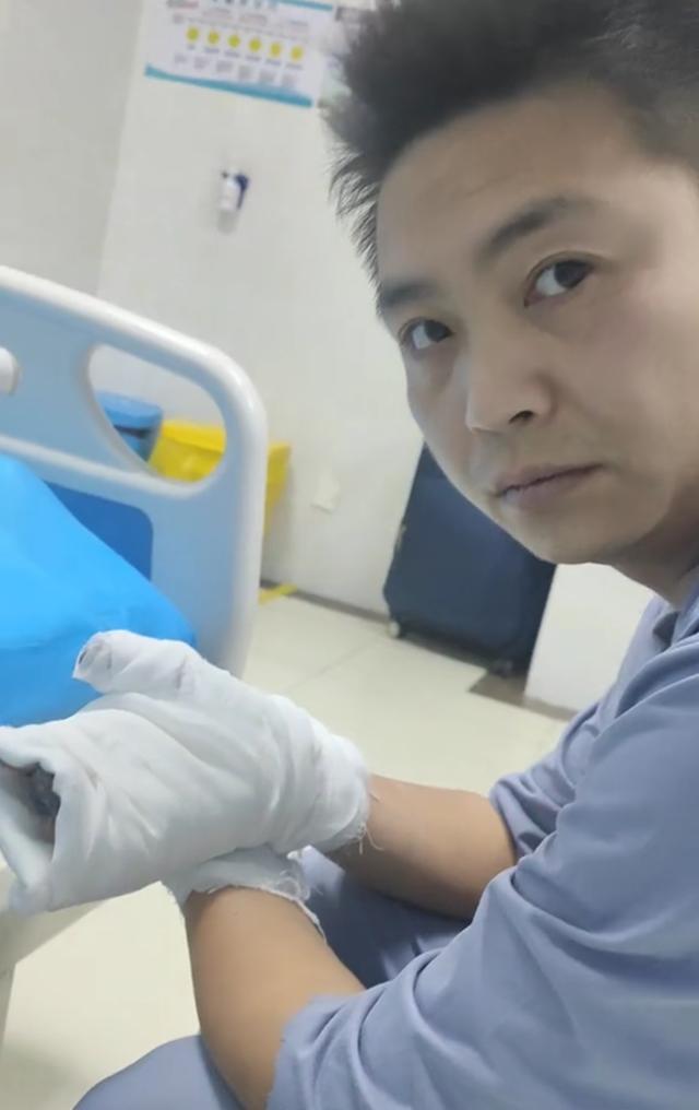 男子从着火电车救下3人手几乎烧废 英勇行为获赞