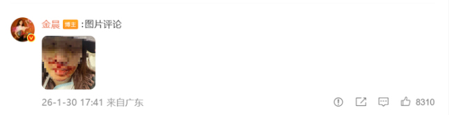 演员金晨交通事故处罚结果公开 罚款1500元