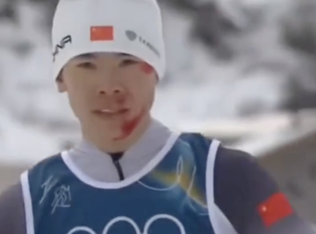 中国运动员面带鲜血冲过终点线 顽强精神感动观众