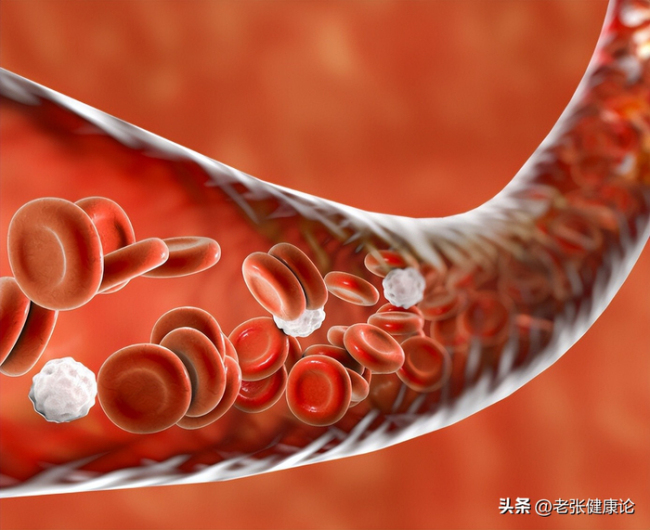 冠心病患者能不能吃高脂食物 血管斑块的“燃料”